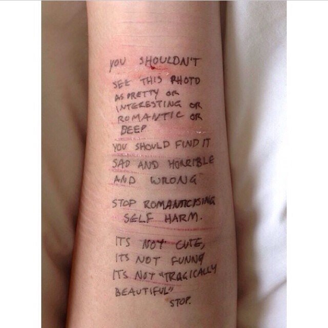 Starting weight:105 Current weight:100 Goal Weight: 80
Bipolar.Depression.Anxiety. Self harm since '09
