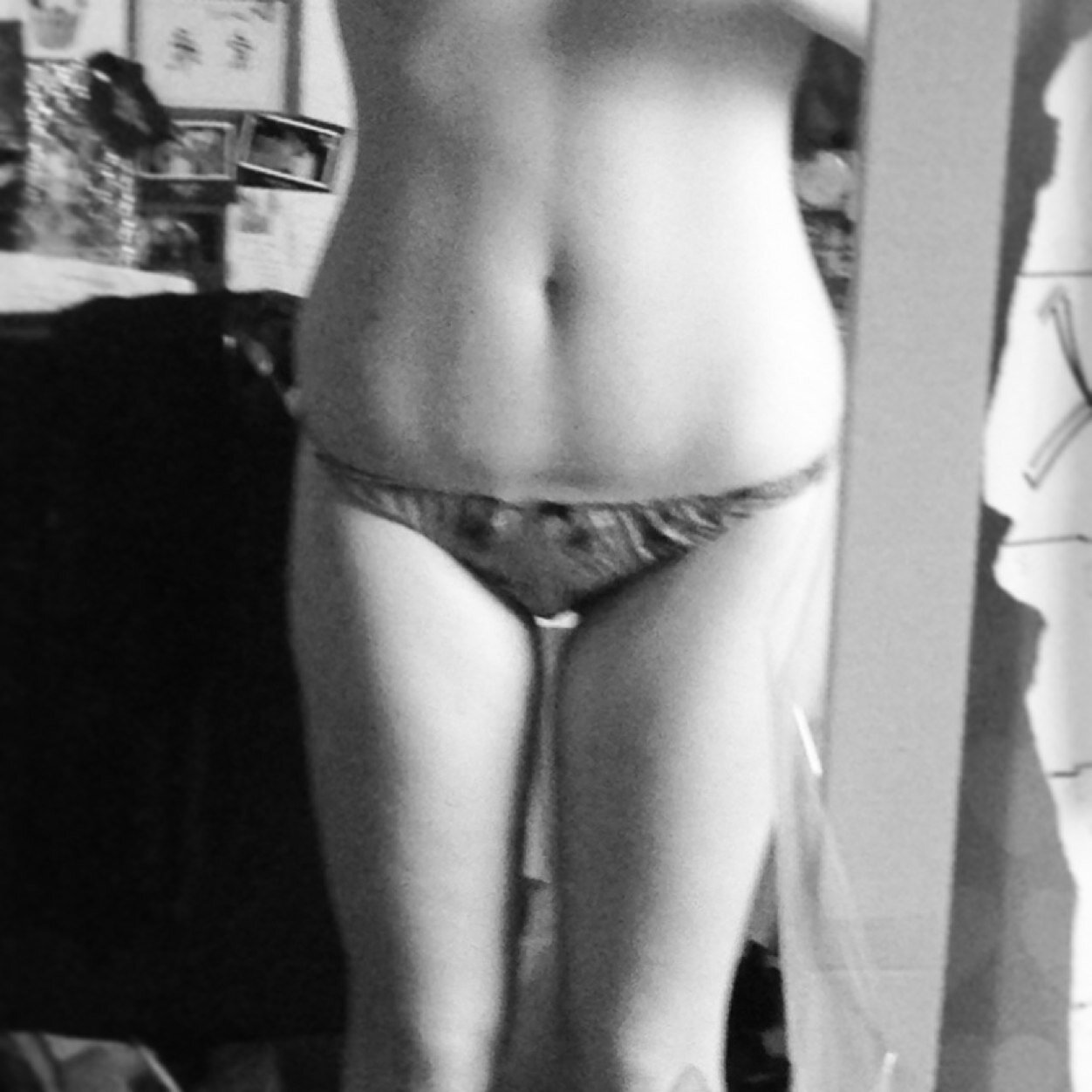 Too fat for recovery, i give up. I'm sorry