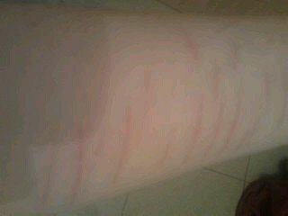 atrapada en una 36 y una M una gorda es lo que soy quiero ser como las demas y jamas lo sere por gorda yo queria ser delgada no esto ...
