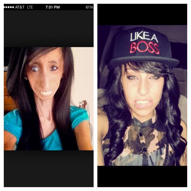 Tia horse power teeth pate yall.