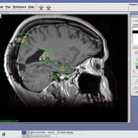 brainmets (@brainmets) 's Twitter Profile