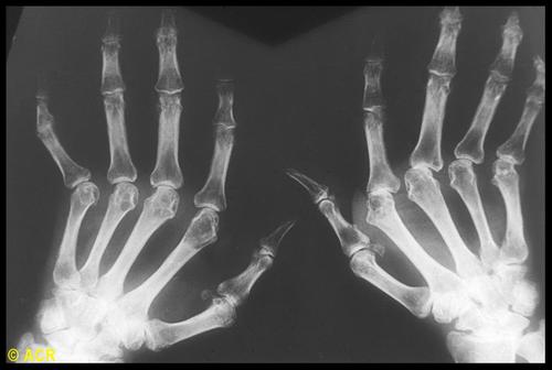 Muscle&joint medical center with a staff academic & community dual board certified rheumatologists. Specialize in complex arthritis,osteoporosis & autoimmunity