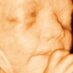 BabyScanStudioPerth (@perth3dbabyscan) Twitter profile photo