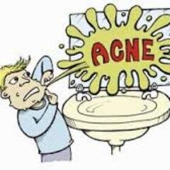 Treatment Acne, Remove Acne,