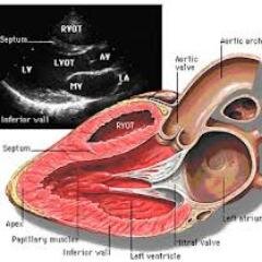 echocardiogram is a graphic outline of the heart’s movement.