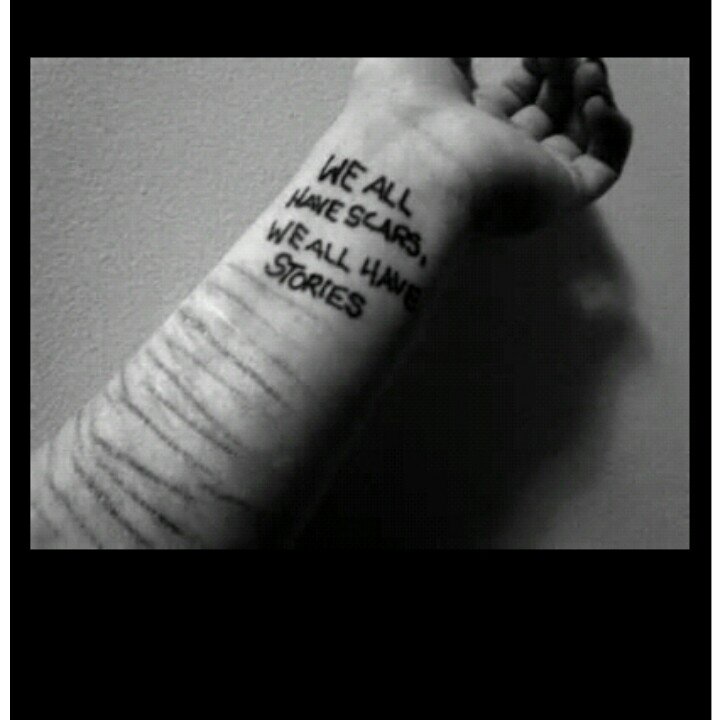 Dying◆Lonely◆Depressed◆Heartbroken◆    CommitSuicides◆
