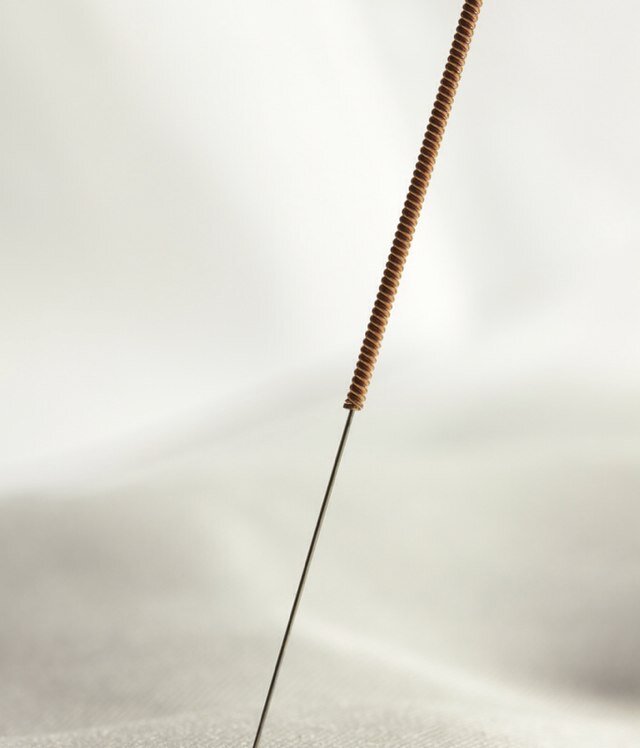 Traditional Chinese Medicine Acupuncture Practitioner, treating a wide range of conditions. Home visits and Practice at Harbourside Health Centre Portishead