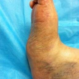 Lil123u4meG's profile picture. 51ex-nurse/disabled chronic rare illnesses HELP ME KEEP my independence by improving my accessibility  Everytime I walk I fracture need . 4whl electric scooter.