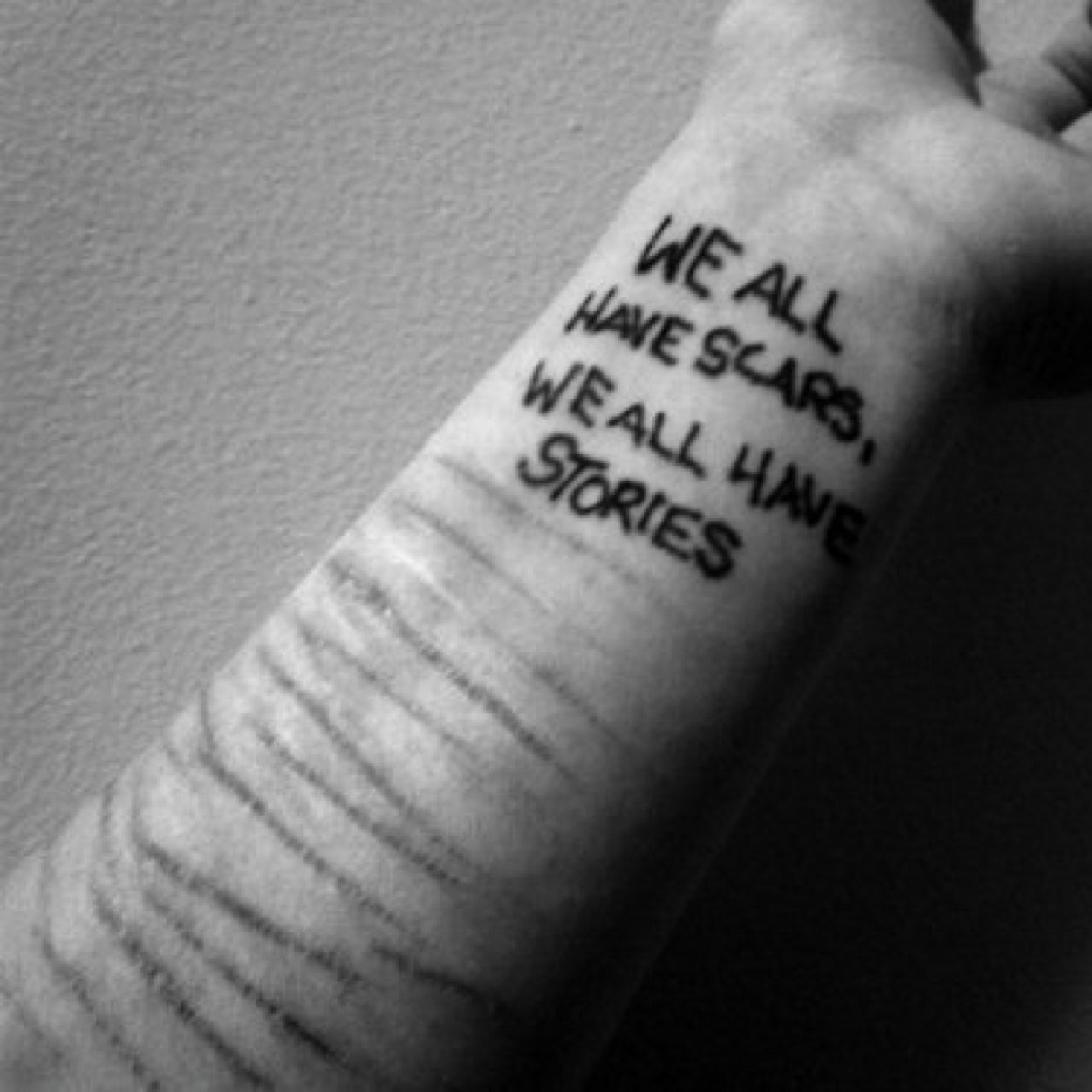 May I kiss your scars?