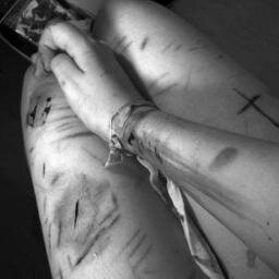 marksonmywrists's profile picture. depression and self harm.
