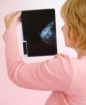 All Types Of Treatments Cancer | Lung Cancer | Breast Cancer | Skin Cancer | Cancer Diet | Prostate cancer