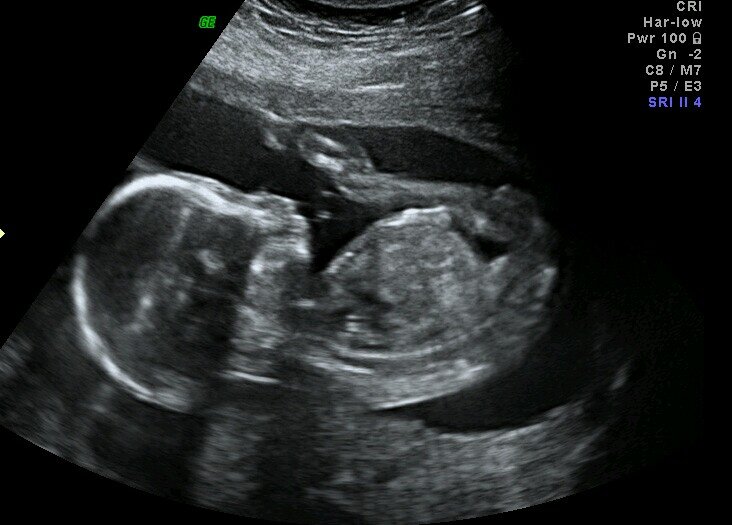 _TheirLittleOne's profile picture. My mother is Pepper Potts @VpottsPepper and My father is Tony Stark (Iron Man) @ironman_tstark.