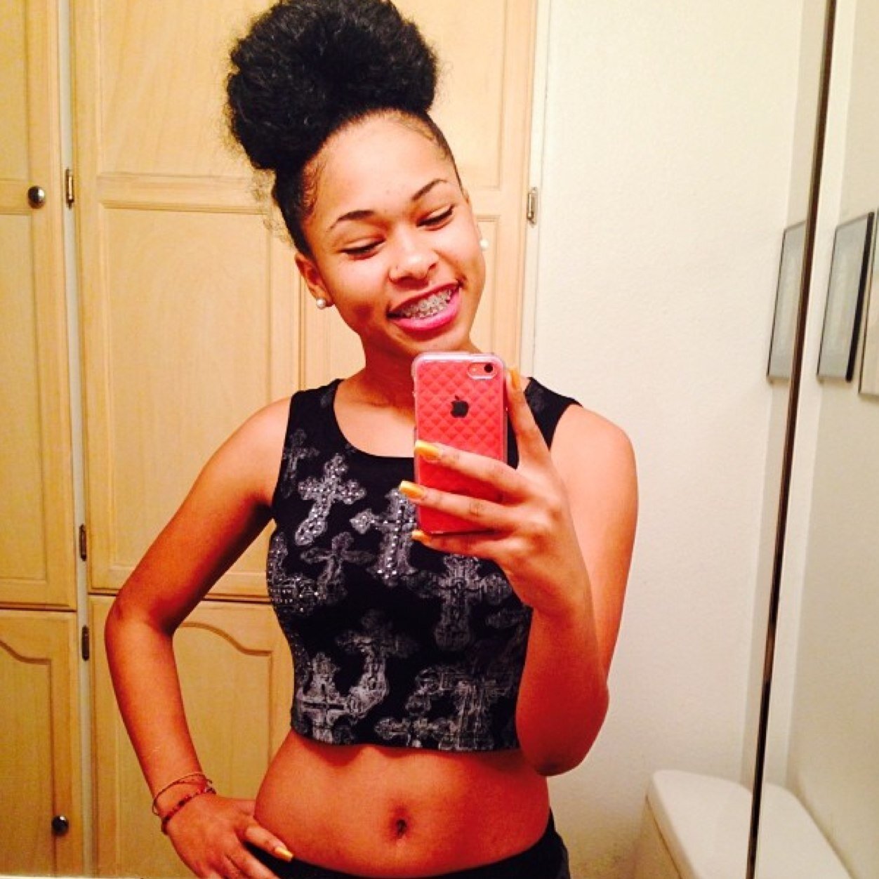 braceface.