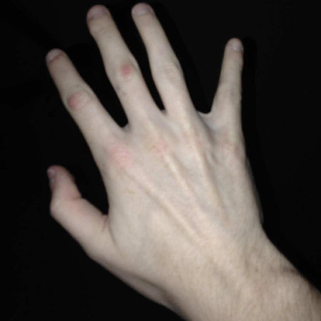 FRIEND PAGE OF SNCK AND HIS HANDS 
LUV LUV LUV! FRIENDS! WOW!