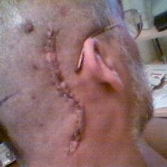 Νευραλγία τριδύμου. #Disabled due to treatments for Trigeminal Neuralgia. No Water, No Life. Earth needs Help. Nothing new is going to happen yesterday.