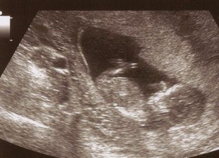 SameraHussain7's profile picture. 