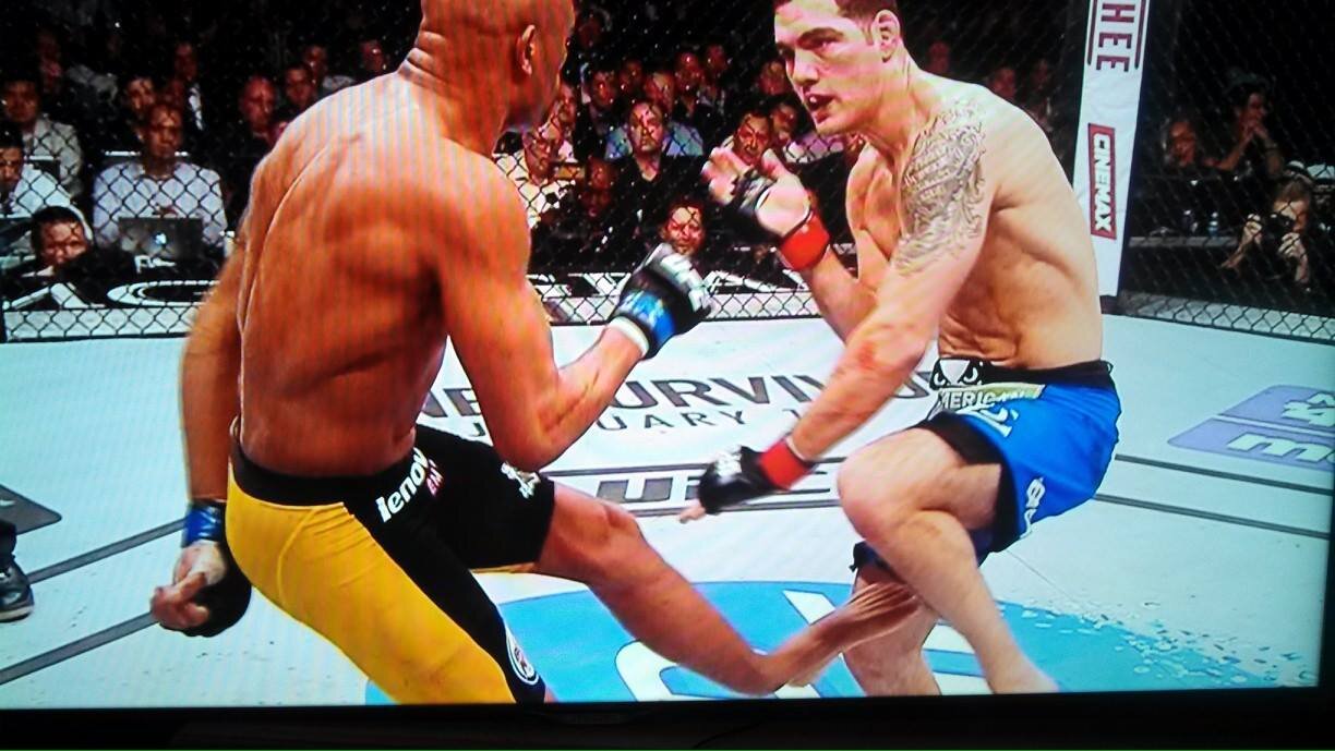 SilvasSnapedLeg's profile picture. In pain...