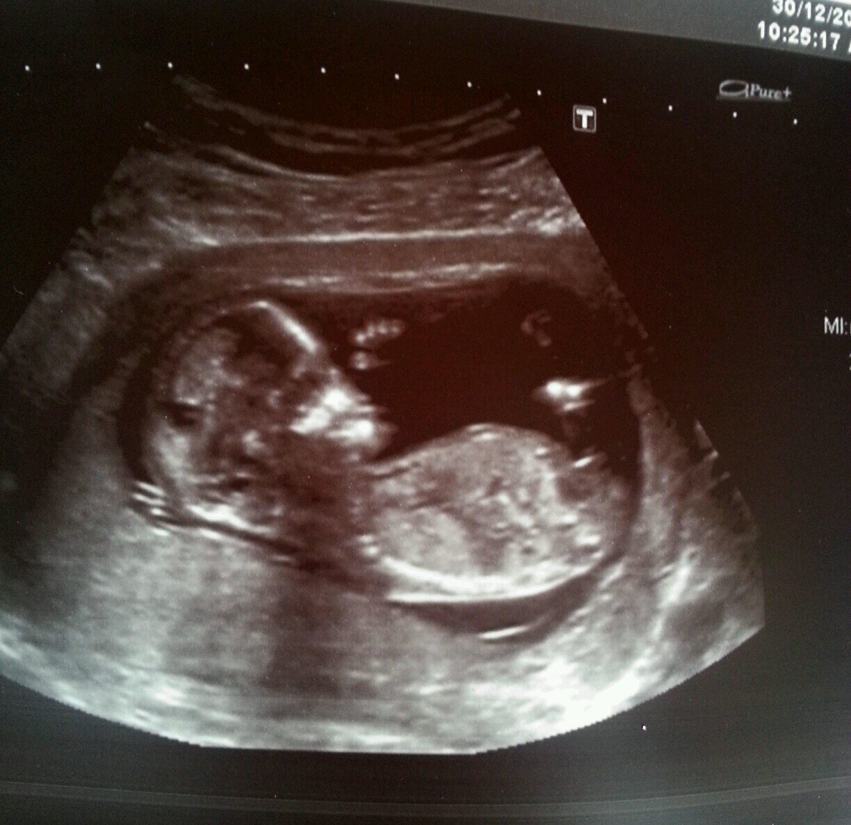 AliMartin101's profile picture. 