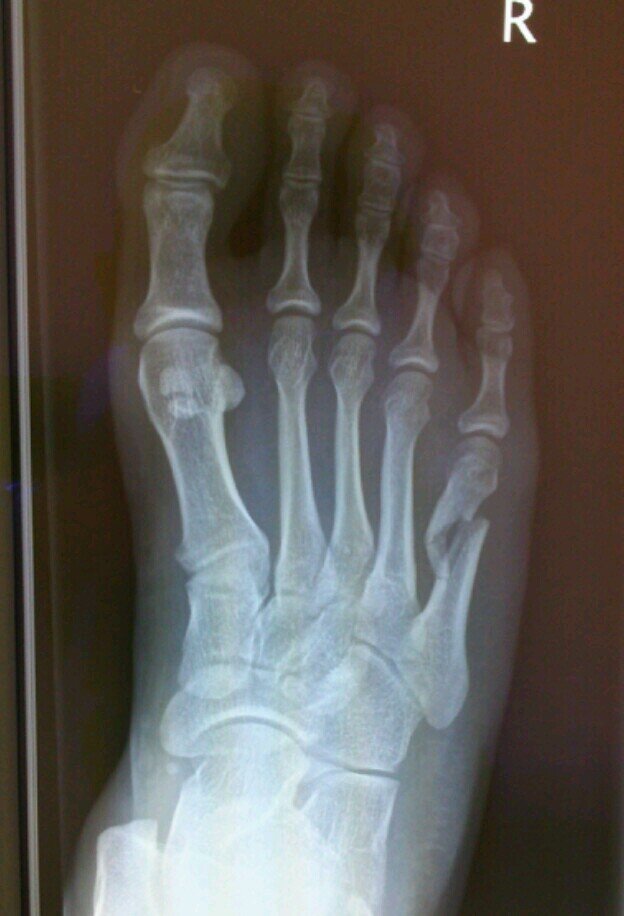 837MHz's profile picture. アイコンは踊りすぎて骨折した過去。 大小に関わらず気軽にイベント呼んで下さい(客として) ブースの前で躍り狂います。 週末はどっかのclubかdiscoに出没するので、気軽に声をかけて頂けたらテキーラショットの刑に処する ＼＼\\٩( 'ω' )و //／／