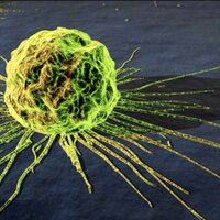 Contra el Cancer (@ascocancer) 's Twitter Profile