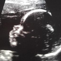 Loving My Little One