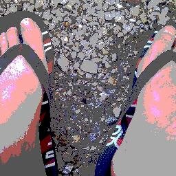 DebsBrownDCHS's profile picture. Diabetes Specialist Podiatrist @Derbyshire Community Health Services