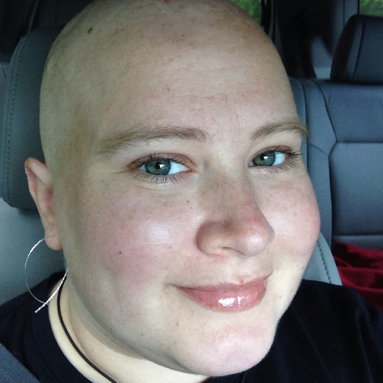 Age 33 w/ lung cancer & brain tumors. My Fundraiser: http://t.co/maVTvzAzK7
