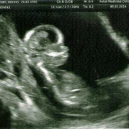 JonMorkey's profile picture. 