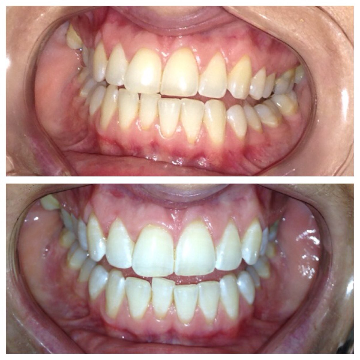 SmileBrightbyLR's profile picture. Fully Qualified Laser Teeth Whitening Technician- Mobile Based. Gain up to 10 shades brighter in just an hour! DM me for more information :)