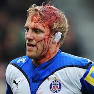 Rugby Injuries