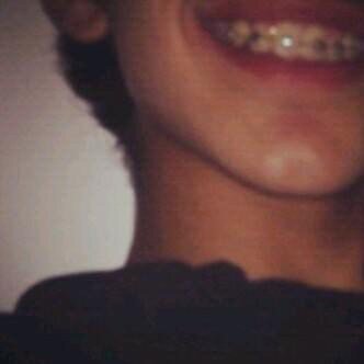 ينادوني ابو خدود :$