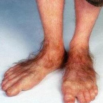 Image result for frodo's feet