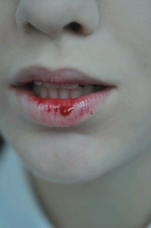sara | depressed | ednos | self harm | lesbian |