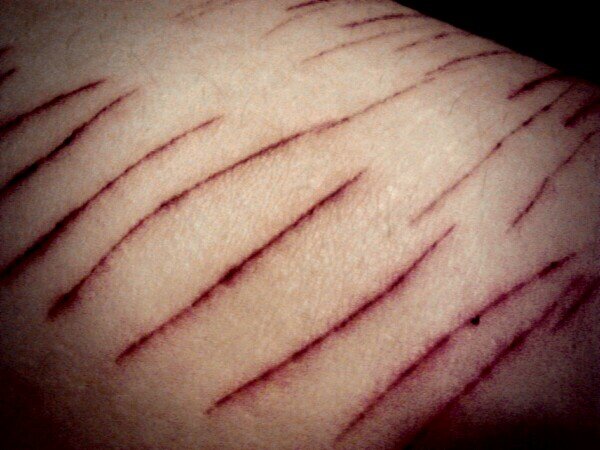 nirrokcares's profile picture. killing me would  be less painful that this /3