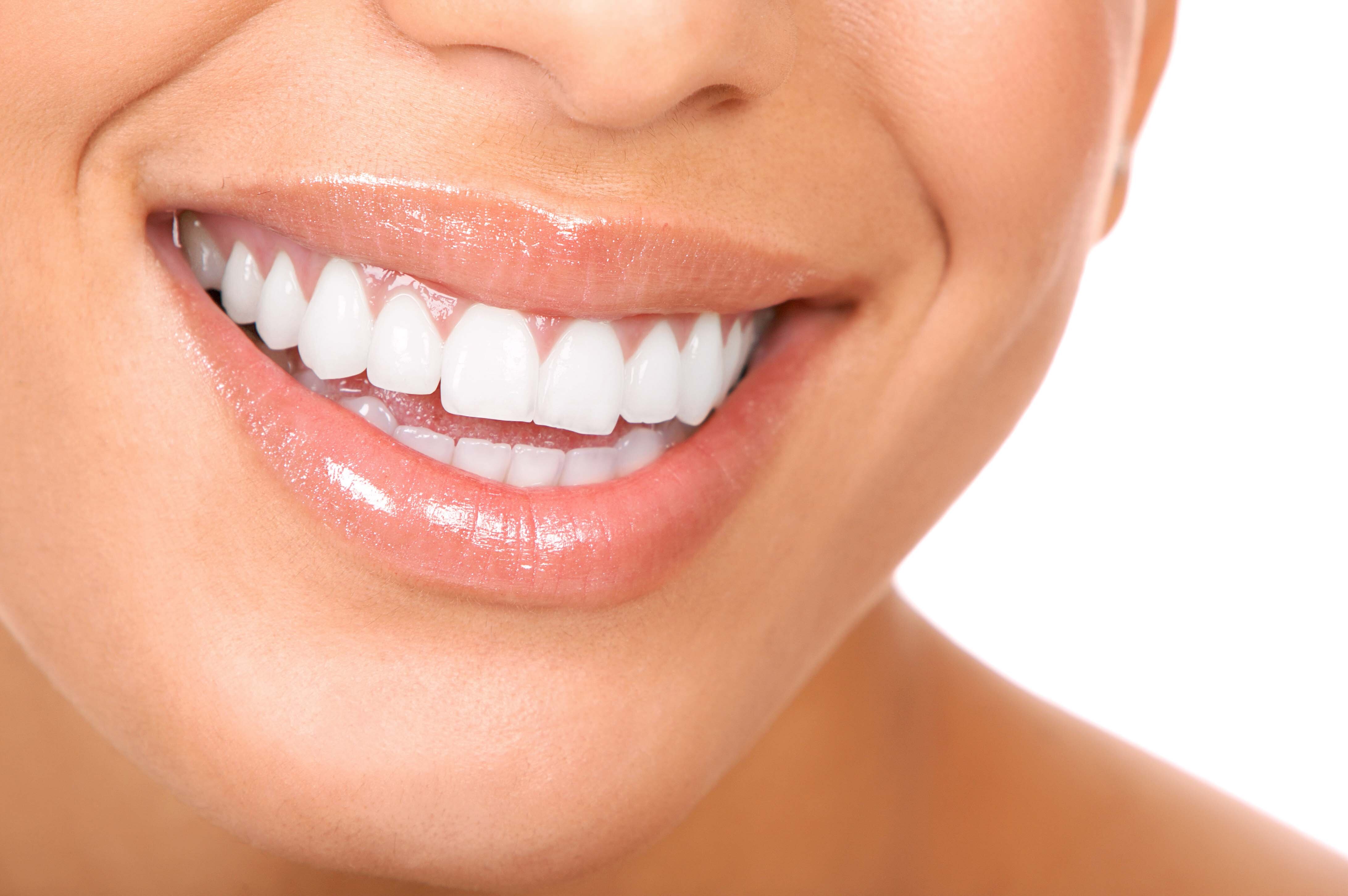 Clareamento dental