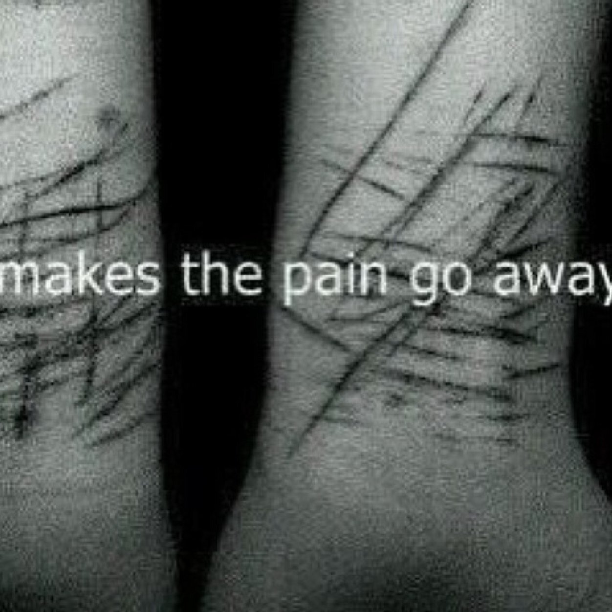 Cutter/depression/suicidal/eating disorders/adhd/anger