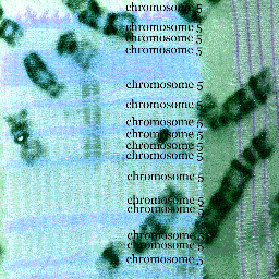 ESRC/Wellcome Trust research programme exploring the social and ethical implications of genomic screening  in the UK. Prof Felicity Boardman, Dr Corinna Clark