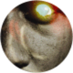 MAT Profile