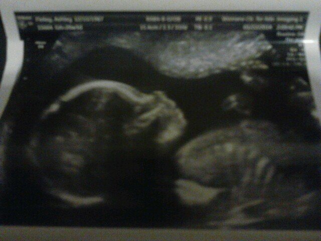 MyKidsFirst23's profile picture. I'm one of the coolest, realest bitches you will ever know. I dont like phoney ppl and I dont surround myself wit bullshit