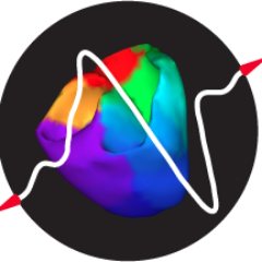 beat-to beat ECG mapping, combined with CT/MRI imaging of the heart, the system reconstructs real-time isochronal and potential maps on epicardium & endocardium