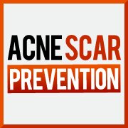 AcnScrPrvention's profile picture. Acne is no innocent and not ok when it comes to social contact. Don't believe me? Bellow is the answer: