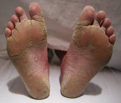 Giving foot jobs daily!