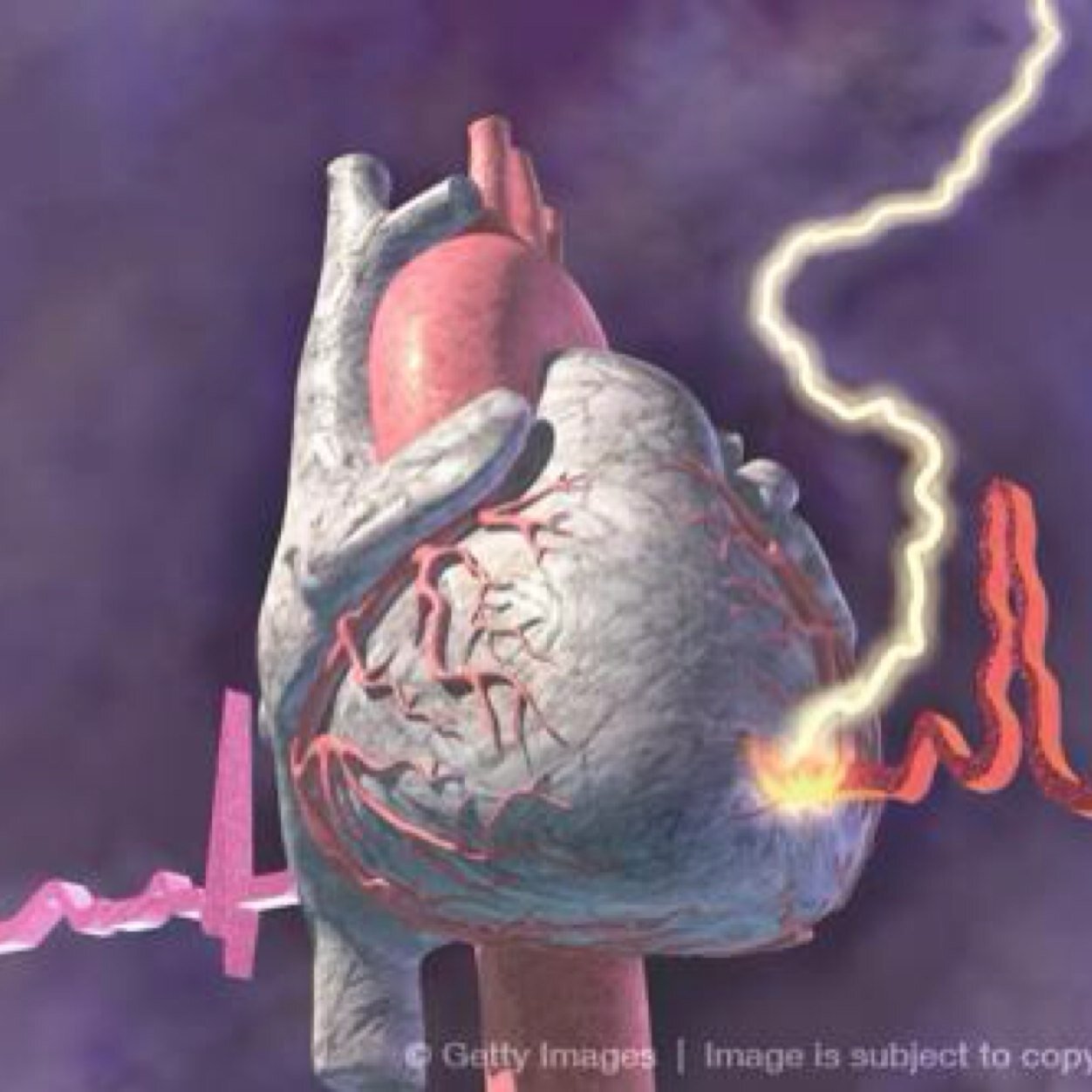 Interventional Cardiologist and Endovascular Specialist. Special interest in Cardiology Education and Research at University Hospitals Cleveland