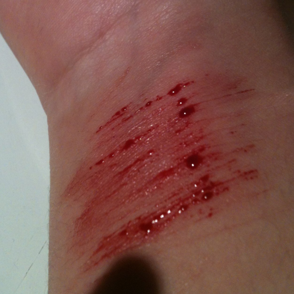 15. Depression and selfharm; fat girl with ED. Suicidal thoughts- Help is NOT welcome// I promise I'll understand you, don't give up.