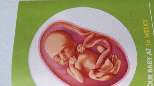 Proud Deivf mommy to baby boy K born @28wks and went to sleep after 10 days.life is so cruel#RIPmyBoy
