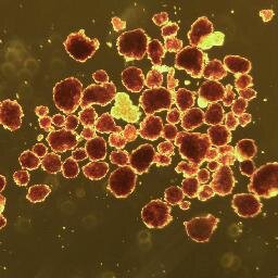 Human Islet Transplant Laboratory. We specialize in islet cell processing, diabetes research and transplantation.