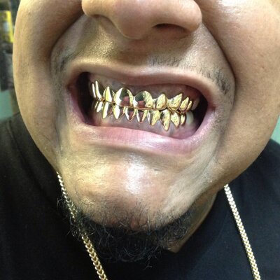 Landogolds Goldteeth Landogolds Twitter