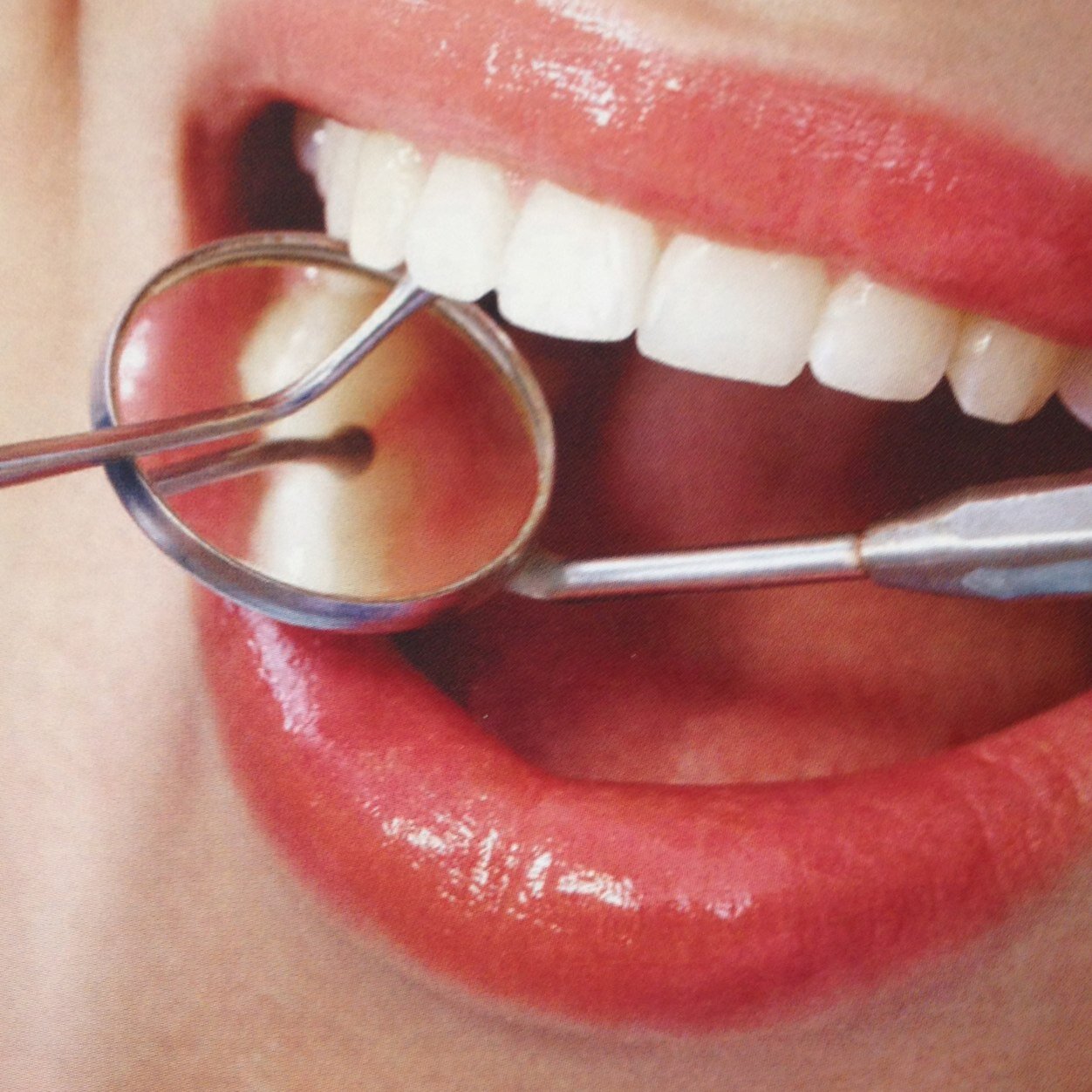 C. #Dentista con Maestría en Prótesis bucal . Blanqueamientos, dentaduras, coronas, carillas, tel 5574927634 whats app @ConyCarrillo