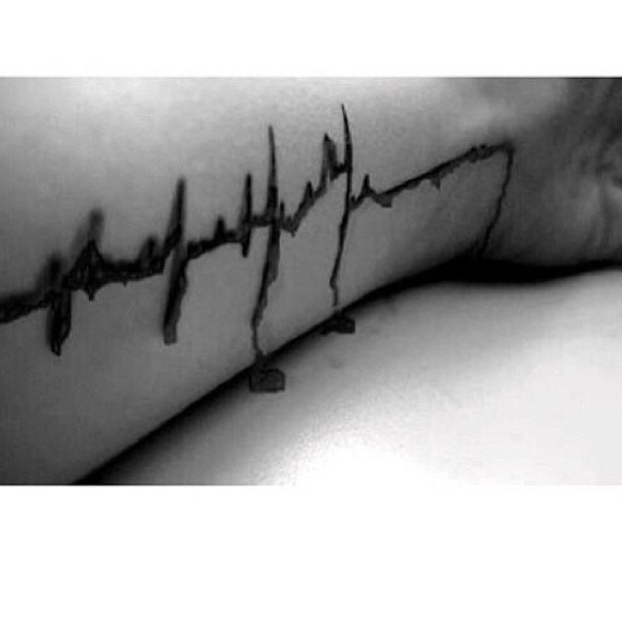 Instagram: @scarred_wrists_forever