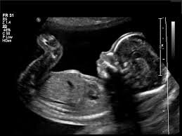 I am the baby of my mommy Saison and my daddy Blaine. How do you say, googoo gaga